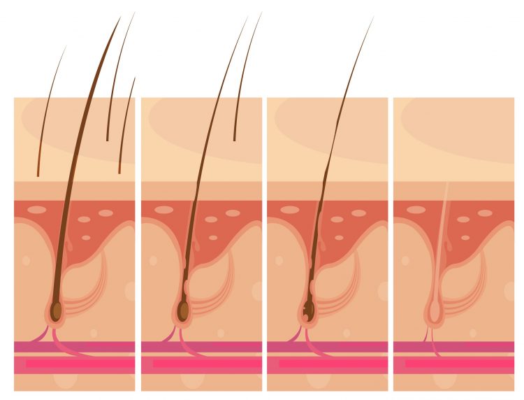 Hair loss steps set