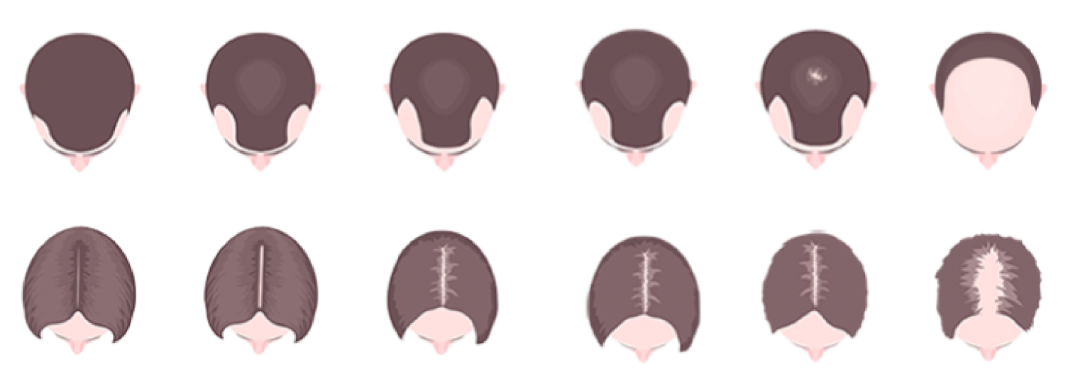 髮漩男女 Thecrownvise